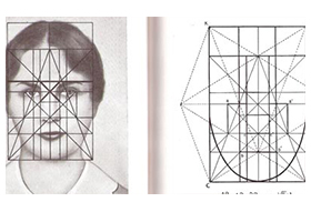 rhinoplastie4